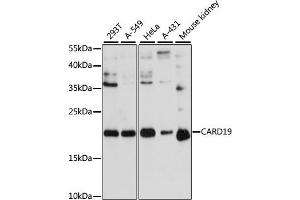 Western blot analysis of extracts of various cell lines, using C antibody (ABIN6127784, ABIN6137941, ABIN6137942 and ABIN6217103) at 1:3000 dilution. (C9orf89 抗体  (AA 1-100))