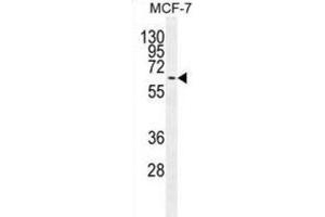 Western Blotting (WB) image for anti-Mitogen-Activated Protein Kinase 15 (MAPK15) antibody (ABIN2995325) (MAPK15 抗体)