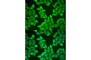 Immunofluorescence analysis of U2OS cell using NGB antibody. (Neuroglobin 抗体)