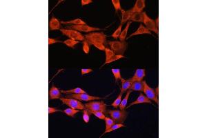 Immunofluorescence analysis of NIH/3T3 cells using AMT Rabbit pAb (ABIN6127345, ABIN6136850, ABIN6136851 and ABIN6225250) at dilution of 1:100. (Aminomethyltransferase 抗体  (AA 107-386))