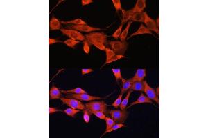 Immunofluorescence analysis of NIH/3T3 cells using AMT Rabbit pAb (ABIN6127345, ABIN6136850, ABIN6136851 and ABIN6225250) at dilution of 1:100. (Aminomethyltransferase 抗体  (AA 107-386))