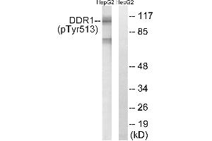 Immunohistochemistry analysis of paraffin-embedded human brain tissue using DDR1 (Phospho-Tyr513) antibody. (DDR1 抗体  (pTyr513))