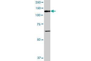 ITGAV MaxPab polyclonal antibody. (CD51 抗体  (AA 1-1048))
