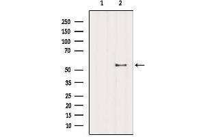 Western blot analysis of extracts from B16F10, using ZNF497 Antibody. (ZNF497 抗体)
