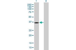 Western Blot analysis of PPP1R3C expression in transfected 293T cell line by PPP1R3C MaxPab polyclonal antibody. (PPP1R3C 抗体  (AA 1-317))