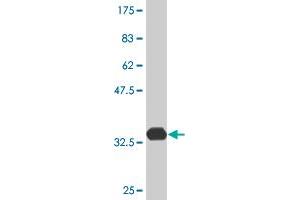 Western Blot detection against Immunogen (33. (ATOX1 抗体  (AA 1-68))