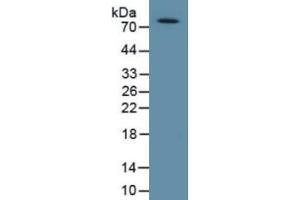 Mouse Capture antibody from the kit in WB with Positive Control: Human lung tissue.