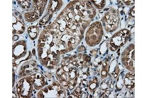 Immunohistochemical staining of paraffin-embedded liver tissue using anti-PPP5C mouse monoclonal antibody. (PP5 抗体)