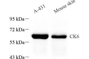Western blot analysis of CK6 (ABIN7074423) at dilution of 1: 1000 (Keratin 6 抗体)