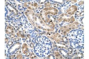 SLC22A3 antibody was used for immunohistochemistry at a concentration of 4-8 ug/ml to stain Epithelial cells of renal tubule (arrows) in Human Kidney. (SLC22A3 抗体)