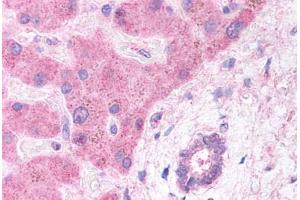 Human Hepatocytes and Bile Duct (formalin-fixed, paraffin-embedded) stained with LRP6 antibody ABIN291653 at 5 ug/ml followed by biotinylated anti-goat IgG secondary antibody ABIN481715, alkaline phosphatase-streptavidin and chromogen. (LRP6 抗体  (AA 1547-1560))