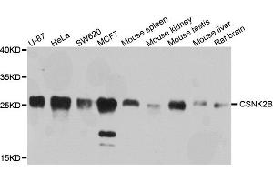 Western blot analysis of extracts of various cells, using CSNK2B antibody. (CSNK2B 抗体)