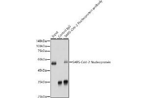 Immunoprecipitation analysis of 300 μg extracts of 293T cells using 3 μg SARS-CoV-2 Nucleoprotein antibody (ABIN7269053). (Nucleoprotein 抗体)