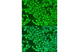 Immunofluorescence analysis of U2OS cells using HIF1A antibody (ABIN2736893) at dilution of 1:100. (HIF1A 抗体)