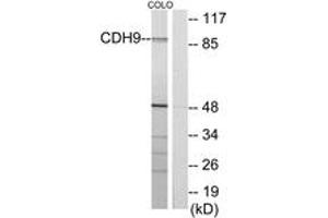 Western blot analysis of extracts from COLO cells, using CDH9 Antibody. (Cadherin 9 抗体  (AA 201-250))