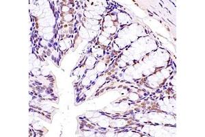 Immunohistochemistry (Paraffin-embedded Sections) (IHC (p)) image for anti-Zinc Finger Protein 307 (ZKSCAN4) antibody (ABIN7076265)