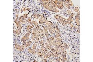 IHC analysis of PYROXD1 using anti-PYROXD1 antibody (ABIN6719650). (PYROXD1 抗体  (AA 48-230))