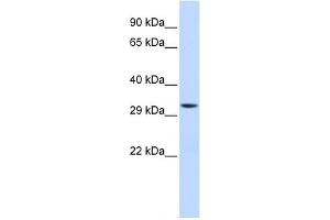 WB Suggested Anti-MTIF3 Antibody Titration: 0.