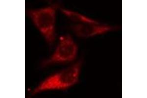 ABIN6275494 staining Hela cells by IF/ICC. (ARHGEF10 抗体  (Internal Region))