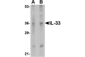 Western blot analysis of IL-33 in human lymph node tissue lysate with AP30427PU-N IL-33 antibody at (A) 1 and (B) 2 μg/ml. (IL-33 抗体  (Center))