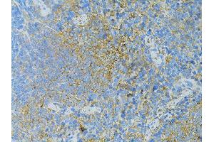 Immunohistochemistry of paraffin-embedded mouse slpeen using TLR4 antibody (ABIN5975781) at dilution of 1/100 (40x lens). (TLR4 抗体)