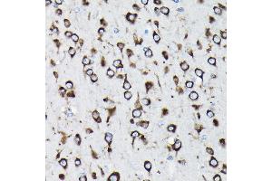 Immunohistochemistry (IHC) image for anti-Ribosomal Protein L23A (RPL23A) (AA 1-156) antibody (ABIN1682576)