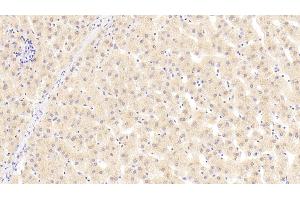 Detection of ANG in Human Liver Tissue using Polyclonal Antibody to Angiogenin (ANG)