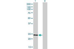Western Blotting (WB) image for anti-RAB7, Member RAS Oncogene Family-Like 1 (RAB7L1) (AA 1-203) antibody (ABIN522412)