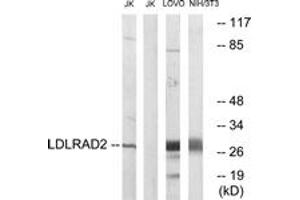 Western blot analysis of extracts from Jurkat/LOVO/NIH-3T3 cells, using LDLRAD2 Antibody. (LDLRAD2 抗体  (AA 130-179))