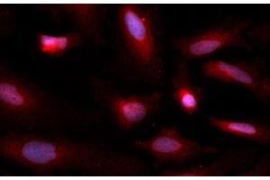 Immunofluorescence (IF) image for anti-Copper Chaperone For Superoxide Dismutase (CCS) (AA 1-274) antibody (APC) (ABIN5565328)