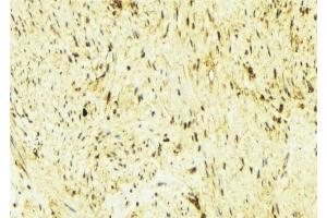 ABIN6276560 at 1/100 staining Mouse muscle tissue by IHC-P. (Tropomyosin 抗体  (N-Term))