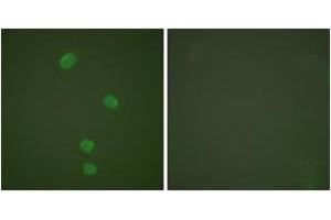 Immunofluorescence analysis of HepG2 cells, using MCM5 Antibody. (MCM5 抗体  (AA 21-70))