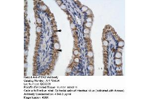 Human Intestine (PITX2 抗体  (N-Term))