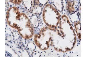 Immunohistochemical staining of paraffin-embedded Human Kidney tissue using anti-DNAJA2 mouse monoclonal antibody. (DNAJA2 抗体)