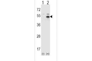 Western blot analysis of ST (arrow) using rabbit polyclonal ST Antibody  (ABIN388974 and ABIN2839216). (STAM 抗体  (C-Term))