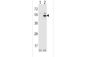 Western blot analysis of ST (arrow) using rabbit polyclonal ST Antibody  (ABIN388974 and ABIN2839216).