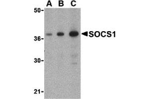 Western Blotting (WB) image for anti-Suppressor of Cytokine Signaling 1 (SOCS1) (C-Term) antibody (ABIN1030688) (SOCS1 抗体  (C-Term))