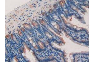 IHC-P analysis of Mouse Kidney Tissue, with DAB staining. (Galectin 9 抗体  (AA 225-353))