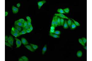 Immunofluorescence staining of HepG2 cells with ABIN7149816 at 1:66, counter-stained with DAPI. (DPPA5 抗体  (AA 1-116))
