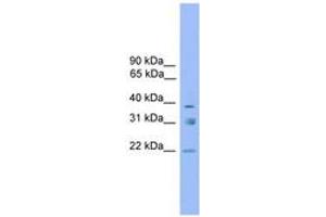 Image no. 1 for anti-Ring Finger Protein 167 (RNF167) (AA 179-228) antibody (ABIN6744738) (RNF167 抗体  (AA 179-228))