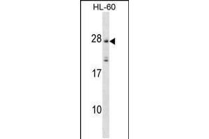 Western blot analysis in HL-60 cell line lysates (35ug/lane). (MS4A5 抗体  (N-Term))