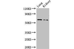 Western Blot Positive WB detected in: Mouse lung tissue, Mouse kidney tissue All lanes: Plbd2 antibody at 3 μg/mL Secondary Goat polyclonal to rabbit IgG at 1/50000 dilution Predicted band size: 66 kDa Observed band size: 66 kDa (PLBD2 抗体  (AA 36-585))
