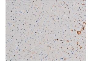 ABIN6267466 at 1/200 staining Mouse heart tissue sections by IHC-P. (CDC25A 抗体  (pThr507))