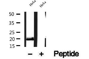 Western blot analysis of extracts of HeLa cells, using OPA3 antibody. (OPA3 抗体  (Internal Region))