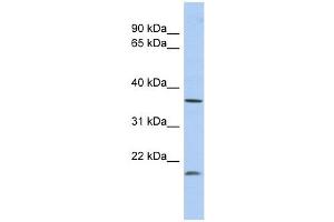 MTHFD2L antibody used at 1 ug/ml to detect target protein. (MTHFD2L 抗体)