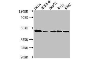 Western Blot Positive WB detected in: Hela whole cell lysate, HEK293 whole cell lysate, HepG2 whole cell lysate, Raji whole cell lysate, K562 whole cell lysate All lanes: CSNK2A1 antibody at 3 μg/mL Secondary Goat polyclonal to rabbit IgG at 1/50000 dilution Predicted band size: 46, 30 kDa Observed band size: 46 kDa (CSNK2A1/CK II alpha 抗体  (AA 1-391))