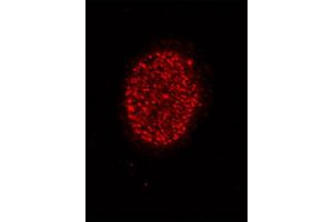Histone H4 acetyl Lys5 antibody tested by immunofluorescence. (Histone H4 抗体  (acLys5))