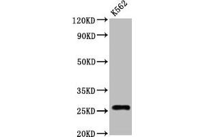 Western Blot Positive WB detected in:K562 whole cell lysate All lanes:CD81 antibody at 1. (Recombinant CD81 抗体)