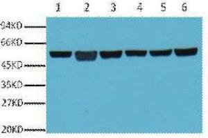 Western Blot (WB) analysis of A549 (1), Rat Brain (2), Mouse Brain (3), Chicken lung (4) and Rabbit testis (5), Sheep muscle (6), diluted at 1:5000. (TUBB 抗体)