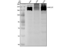 Western blot analysis of SMCHD1 using anti-SMCHD1 antibody (ABIN7606327).
